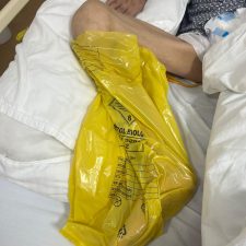 Premiera medicala la Spitalul Judetean Valcea – „bataia de joc” – unguent naturist – oficial pe lista tratamentelor